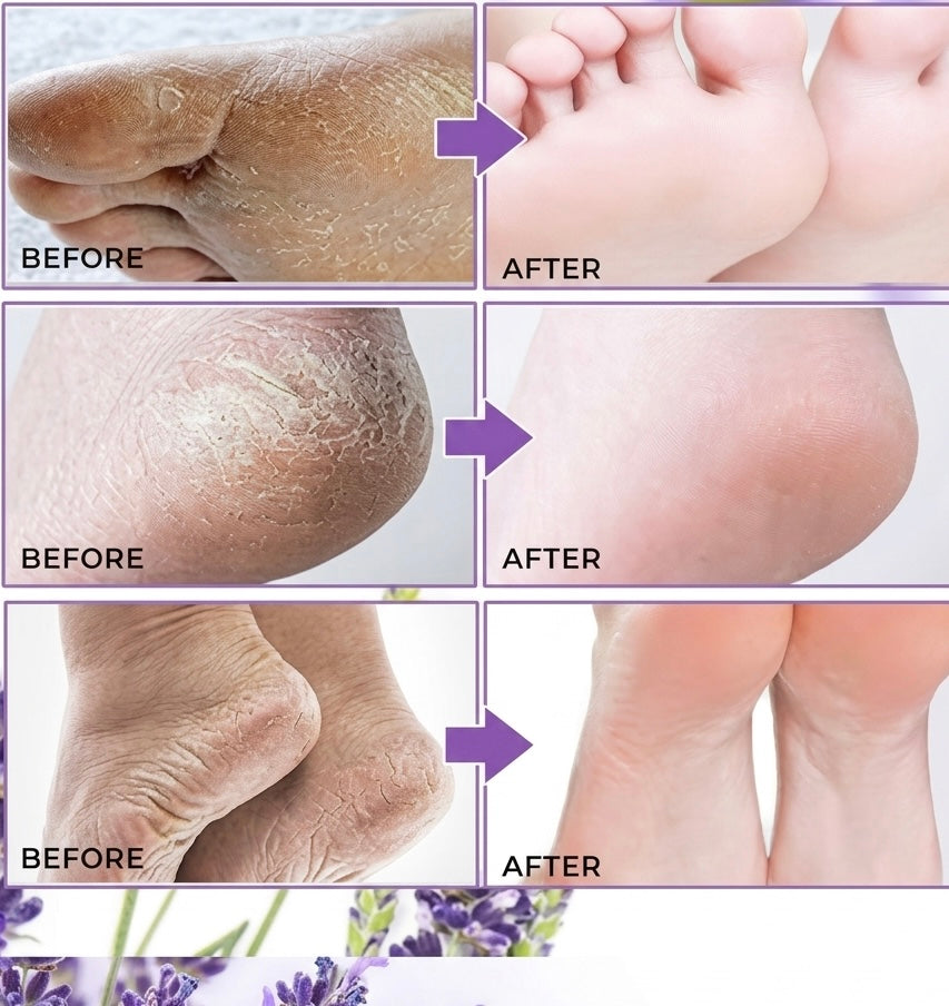 Foot Peel Mask